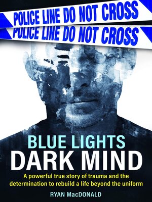 cover image of Blue Lights Dark Mind